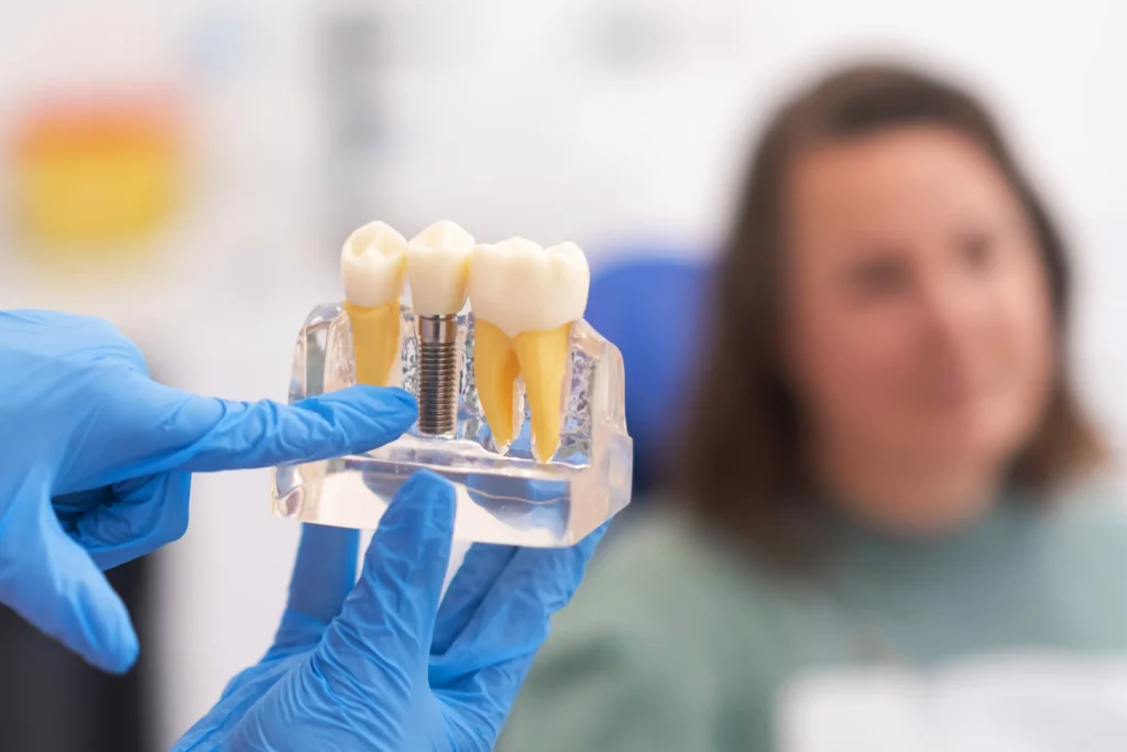 How Much Do Dental Implants Cost in Edinburgh?